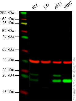 Western blot - Anti-COMT antibody [EPR6490] (AB126618), expandable thumbnail