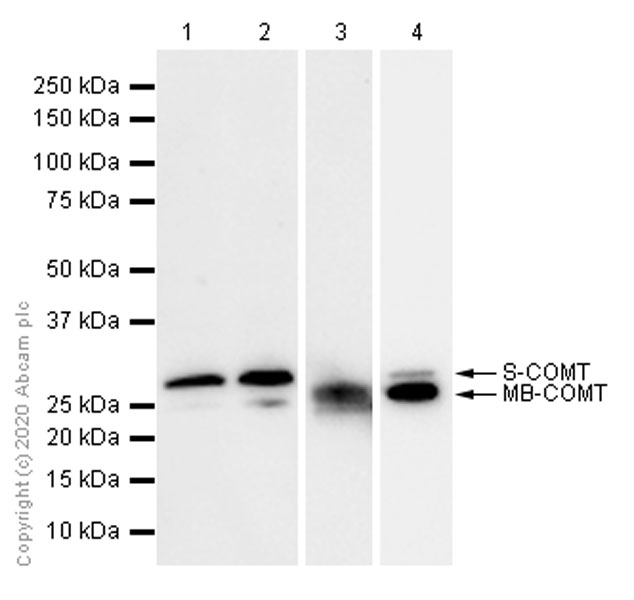 Western blot - Anti-COMT antibody [EPR6490] - BSA and Azide free (AB248128), expandable thumbnail