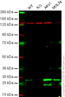 Western blot - Anti-COMT antibody [EPR6491(B)] (AB124813)