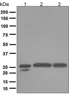 Western blot - Anti-COMT antibody [EPR6491(B)] (AB124813)
