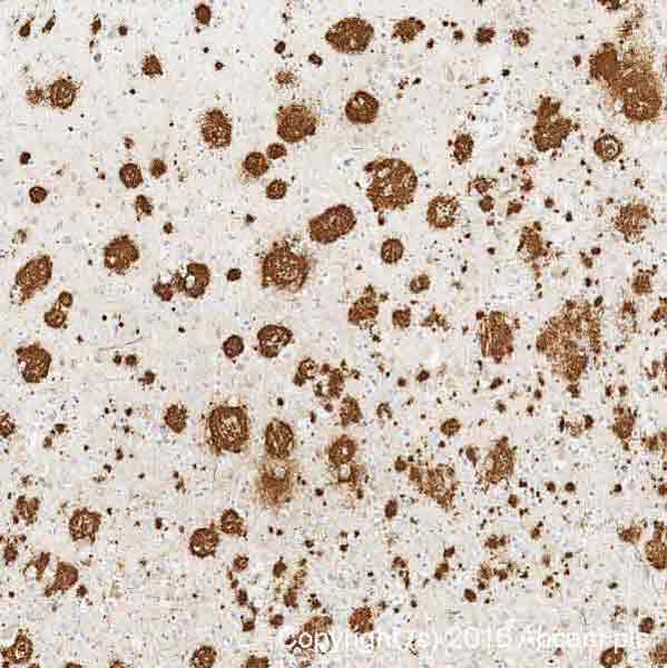 Immunohistochemistry (Formalin/PFA-fixed paraffin-embedded sections) - Conformation-Specific Amyloid beta Antibody Sampler Panel (AB218719), expandable thumbnail
