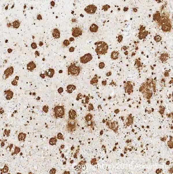 Immunohistochemistry (Formalin/PFA-fixed paraffin-embedded sections) - Conformation-Specific Amyloid beta Antibody Sampler Panel (AB218719)