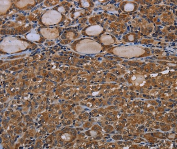 Immunohistochemistry (Formalin/PFA-fixed paraffin-embedded sections) - Anti-Connexin 30.3 / GJB4 antibody (AB199178)
