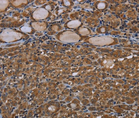 Immunohistochemistry (Formalin/PFA-fixed paraffin-embedded sections) - Anti-Connexin 30.3 / GJB4 antibody (AB199178)