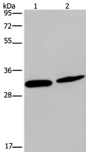 Western blot - Anti-Connexin 30.3 / GJB4 antibody (AB199178)