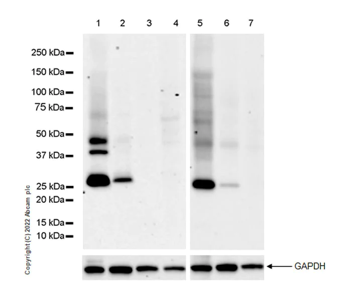 Western blot - Anti-Connexin 32 / GJB1 antibody [EPR26417-44] (AB300401)