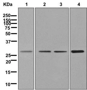 Western blot - Anti-Connexin 32 / GJB1 antibody [EPR8036(2)] - BSA and Azide free (AB250497)