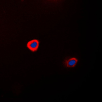 Immunocytochemistry/ Immunofluorescence - Anti-Connexin 43 / GJA1 antibody (AB230537)