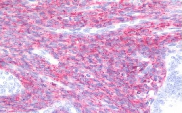 Immunohistochemistry (Formalin/PFA-fixed paraffin-embedded sections) - Anti-Connexin 43 / GJA1 antibody - C-terminal (AB219493), expandable thumbnail