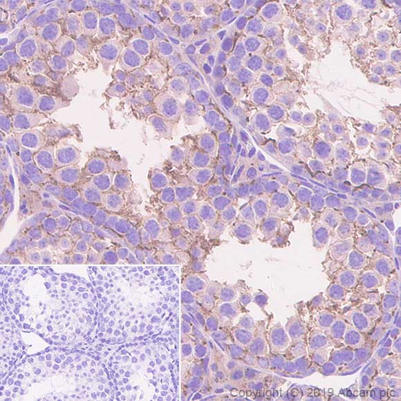 Immunohistochemistry (Formalin/PFA-fixed paraffin-embedded sections) - Anti-Connexin 43 / GJA1 antibody [EPR22955-101] - BSA and Azide free (AB259276), expandable thumbnail