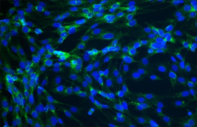 Immunocytochemistry - Anti-Connexin 43 / GJA1 antibody - Intercellular Junction Marker (AB11370)