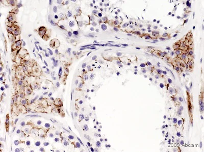 Immunohistochemistry (Formalin/PFA-fixed paraffin-embedded sections) - Anti-Connexin 43 / GJA1 antibody - Intercellular Junction Marker (AB11370)