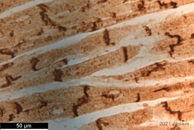 Immunohistochemistry (Formalin/PFA-fixed paraffin-embedded sections) - Anti-Connexin 43 / GJA1 antibody - Intercellular Junction Marker (AB11370)