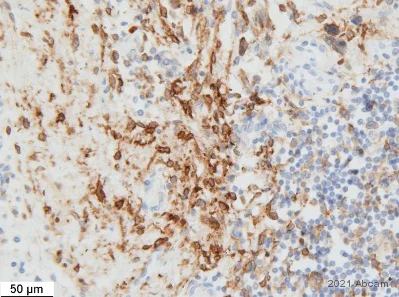 Immunohistochemistry (Formalin/PFA-fixed paraffin-embedded sections) - Anti-Connexin 43 / GJA1 antibody - Intercellular Junction Marker (AB11370)