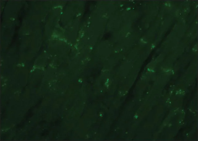 Immunohistochemistry (Formalin/PFA-fixed paraffin-embedded sections) - Anti-Connexin 43 / GJA1 antibody - Intercellular Junction Marker (AB11370)