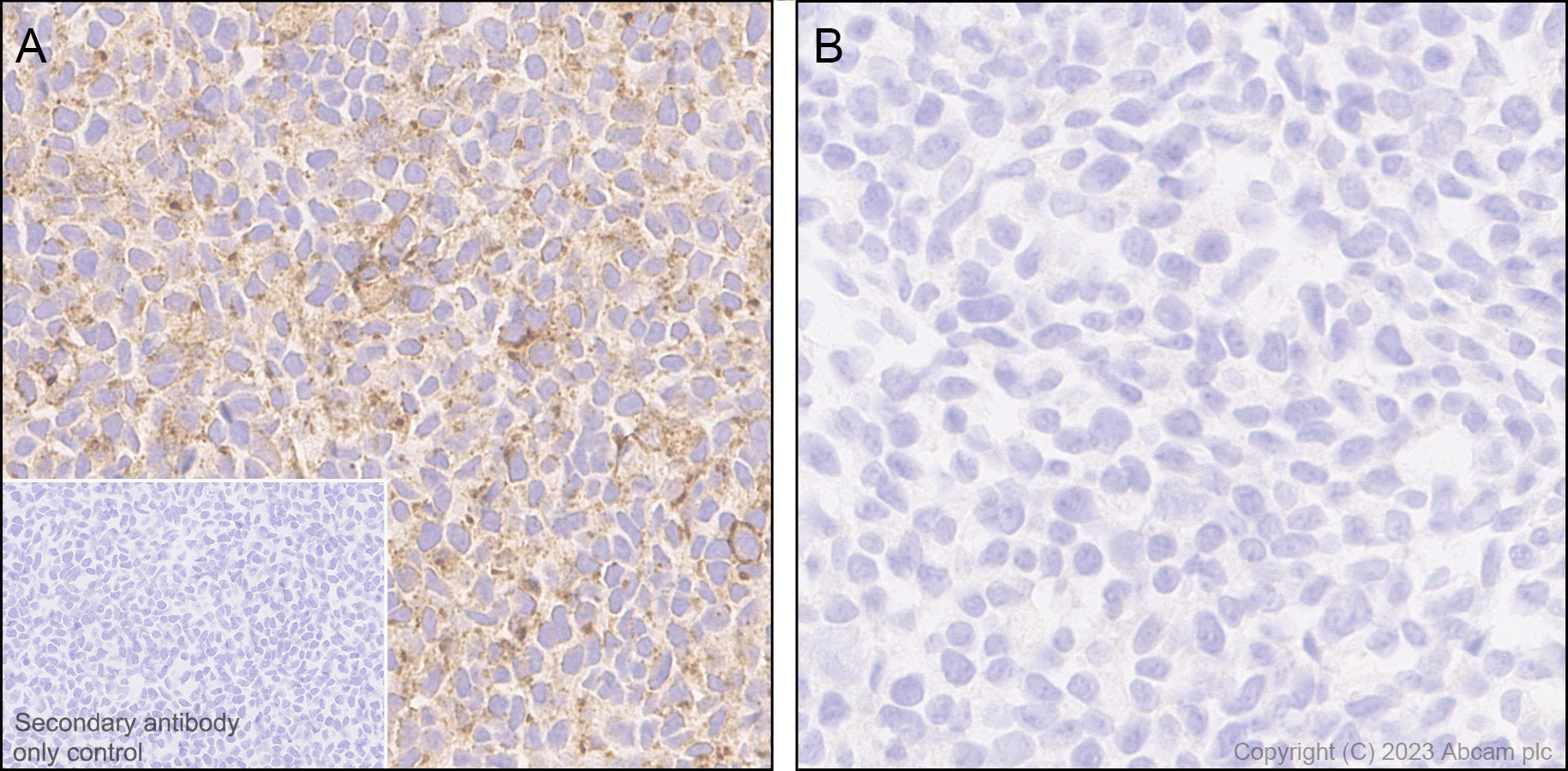 Immunohistochemistry (Formalin/PFA-fixed paraffin-embedded sections) - Anti-Connexin 43 / GJA1 antibody [RM1071] (ab314908), expandable thumbnail