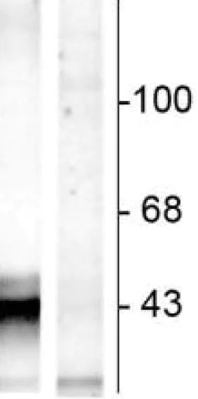 Western blot - Anti-Connexin 43 / GJA1 (phospho S368) antibody (AB30559)