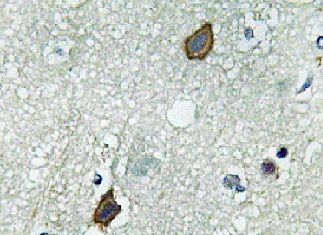 Immunohistochemistry (Formalin/PFA-fixed paraffin-embedded sections) - Anti-Connexin 45/GJA7/Cx45 antibody (AB135474)