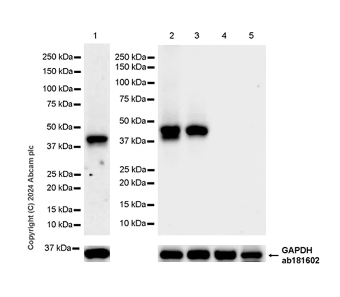 Western blot - Anti-Connexin 45/GJA7/Cx45 antibody [EPR26705-152] - BSA and Azide free (AB316743)
