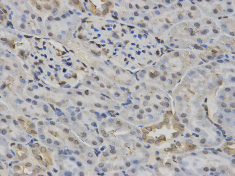 Immunohistochemistry (Formalin/PFA-fixed paraffin-embedded sections) - Anti-Constitutive androstane receptor antibody (AB186869)