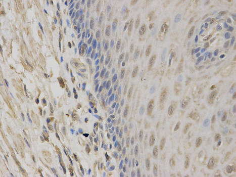 Immunohistochemistry (Formalin/PFA-fixed paraffin-embedded sections) - Anti-Constitutive androstane receptor antibody (AB186869)