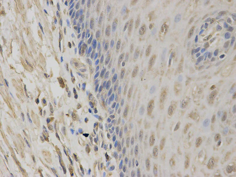 Immunohistochemistry (Formalin/PFA-fixed paraffin-embedded sections) - Anti-Constitutive androstane receptor antibody (AB186869)