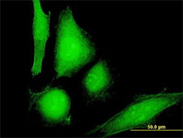Immunocytochemistry/ Immunofluorescence - Anti-COP antibody (AB168243)