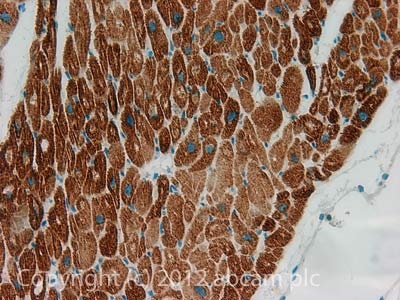 Immunohistochemistry (Formalin/PFA-fixed paraffin-embedded sections) - Anti-COP1 antibody [1E4] (AB56400), expandable thumbnail