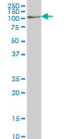 Western blot - Anti-COP1 antibody [1E4] (AB56400), expandable thumbnail