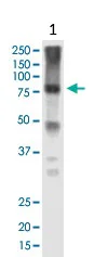 Western blot - Anti-COP1 antibody [1E4] (AB56400)
