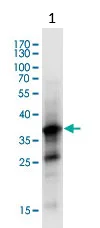 Western blot - Anti-COP1 antibody [1E4] (AB56400)