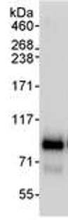 Immunoprecipitation - Anti-COP1 antibody (AB70889)