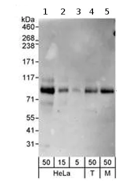 Western blot - Anti-COP1 antibody (AB70889)