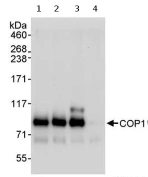Immunoprecipitation - Anti-COP1 antibody (AB70890)