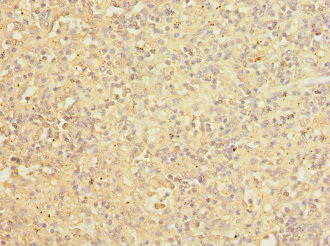 Immunohistochemistry (Formalin/PFA-fixed paraffin-embedded sections) - Anti-COPB2 antibody (AB229639)