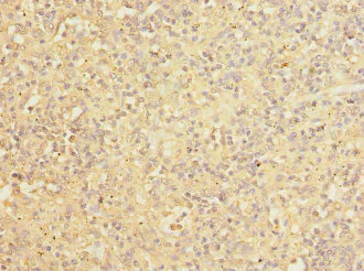 Immunohistochemistry (Formalin/PFA-fixed paraffin-embedded sections) - Anti-COPB2 antibody (AB229639)