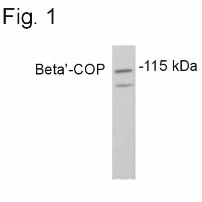 Western blot - Anti-COPB2 antibody (AB2915)