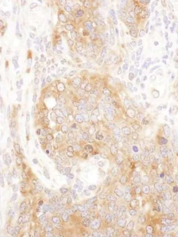Immunohistochemistry (Formalin/PFA-fixed paraffin-embedded sections) - Anti-COPB2 antibody - C-terminal (AB192924)