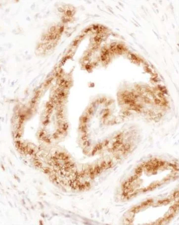 Immunohistochemistry (Formalin/PFA-fixed paraffin-embedded sections) - Anti-COPB2 antibody - C-terminal (AB192924)
