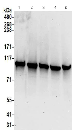 Western blot - Anti-COPB2 antibody - C-terminal (AB192924)