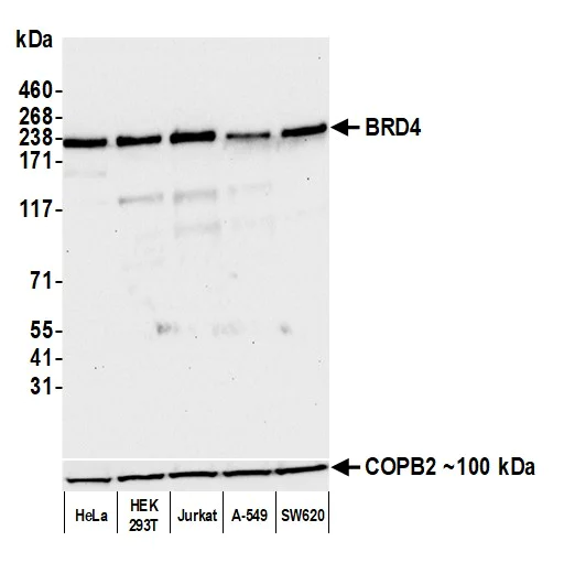 Western blot - Anti-COPB2 antibody - C-terminal (AB192924)
