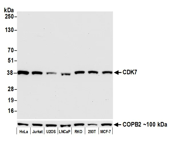 Western blot - Anti-COPB2 antibody - C-terminal (AB192924)