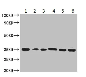 Western blot - Anti-COPE antibody (AB235061)