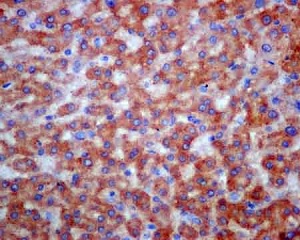 Immunohistochemistry (Formalin/PFA-fixed paraffin-embedded sections) - Anti-COPE antibody [EPR12579] (AB180946)