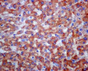 Immunohistochemistry (Formalin/PFA-fixed paraffin-embedded sections) - Anti-COPE antibody [EPR12579] - BSA and Azide free (AB250278)