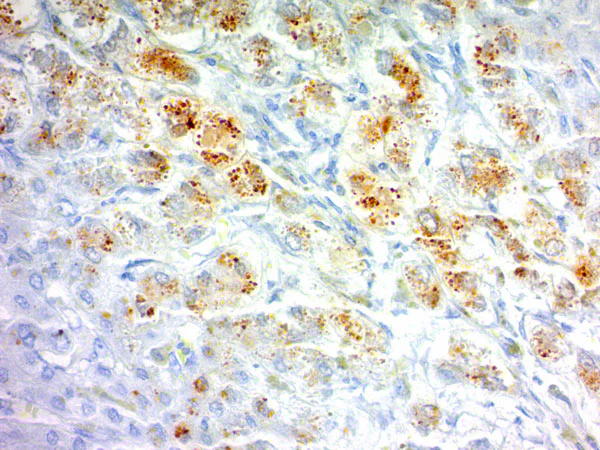 Immunohistochemistry (Formalin/PFA-fixed paraffin-embedded sections) - Copper Stain Kit (AB150666)