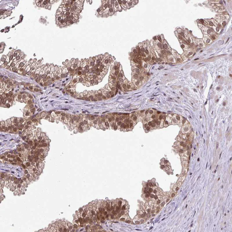 Immunohistochemistry (Formalin/PFA-fixed paraffin-embedded sections) - Anti-COPRS/COPR5 antibody (AB185467)