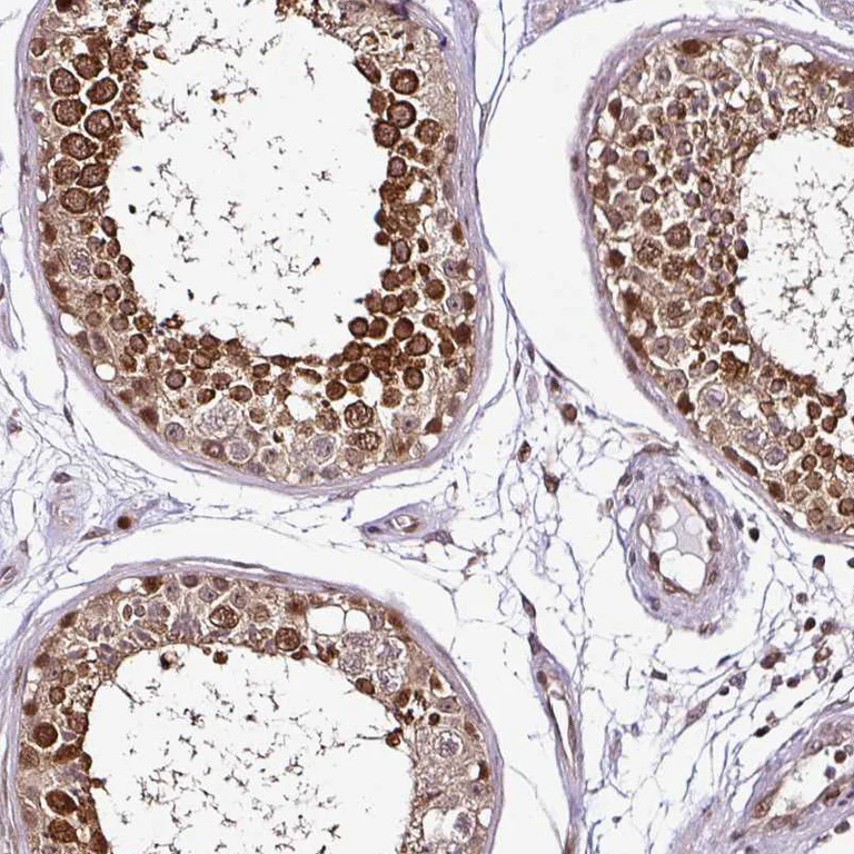 Immunohistochemistry (Formalin/PFA-fixed paraffin-embedded sections) - Anti-COPRS/COPR5 antibody (AB185467)