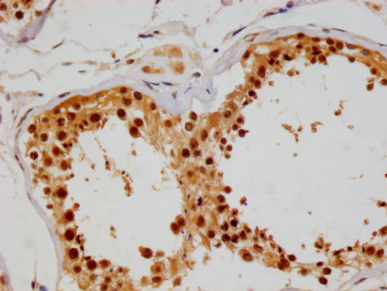Immunohistochemistry (Formalin/PFA-fixed paraffin-embedded sections) - Anti-COPS3/CSN3 antibody [3F9] (AB314042)