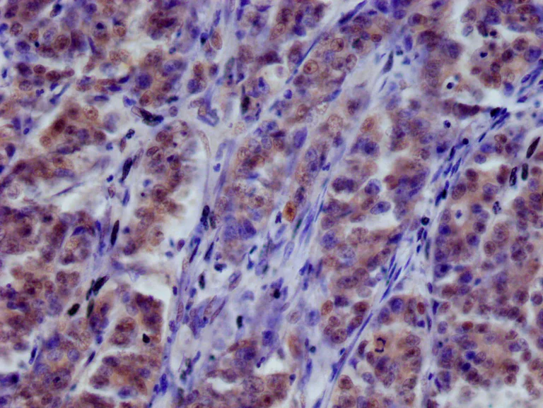 Immunohistochemistry (Formalin/PFA-fixed paraffin-embedded sections) - Anti-COPS3/CSN3 antibody [3F9] (AB314042)